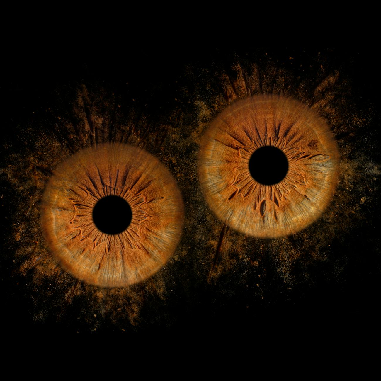 Metastatic Ocular Tumors