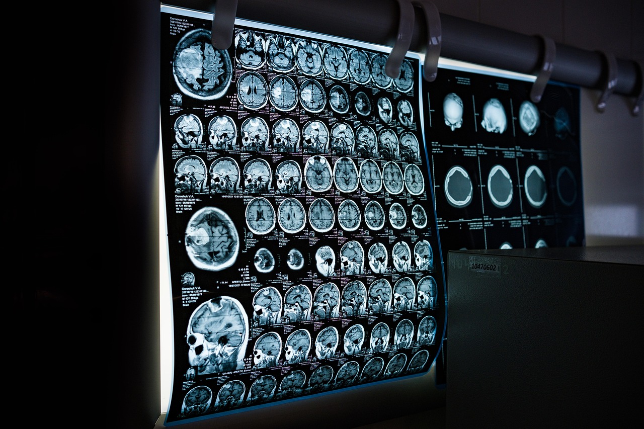 Research Methods in Neurology