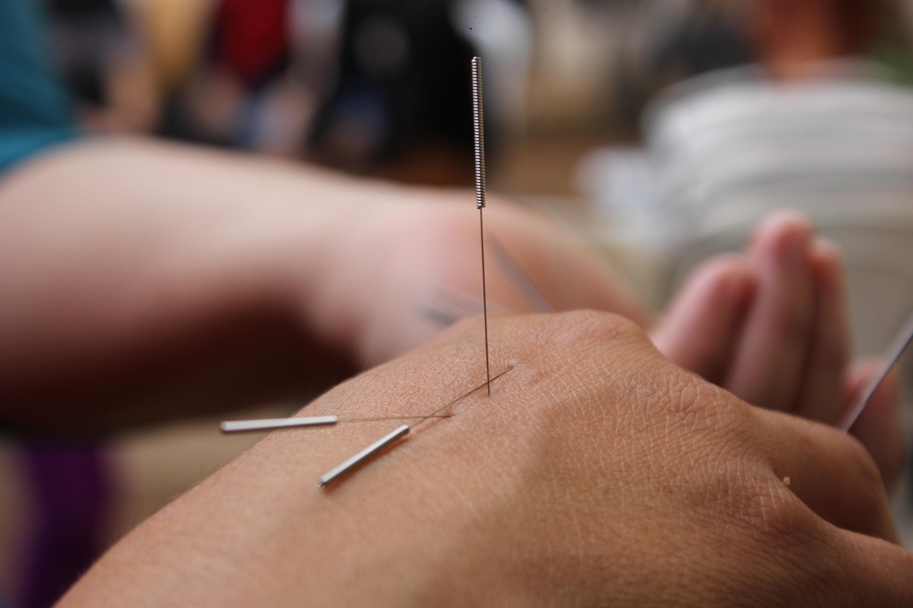 Clinical Practice In Acupuncture For Cancer Patients