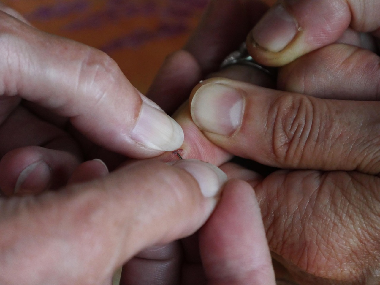 Legal and Ethical Considerations in Wound Management