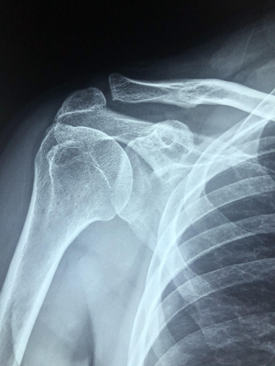 Deep Learning in Radiology