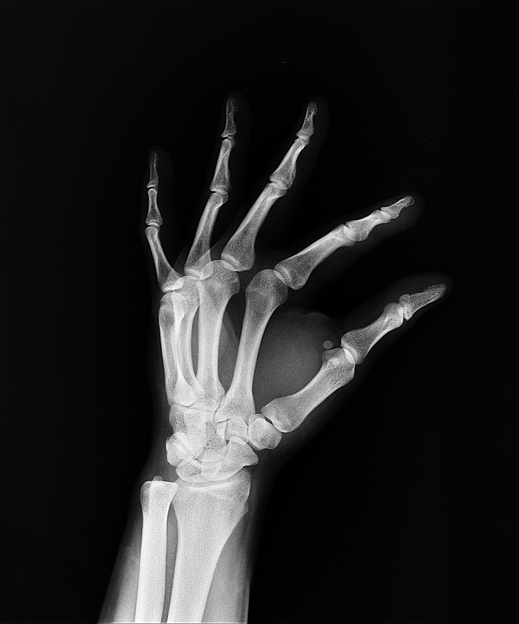 Computer-Aided Diagnosis in Radiology