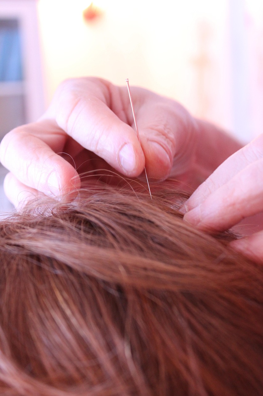 Acupuncture for Internal Medicine Disorders