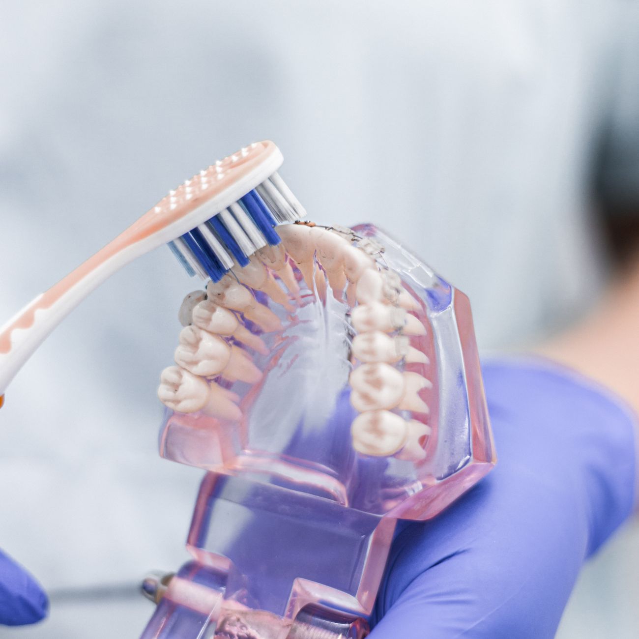 AI Integration in Dental Implants