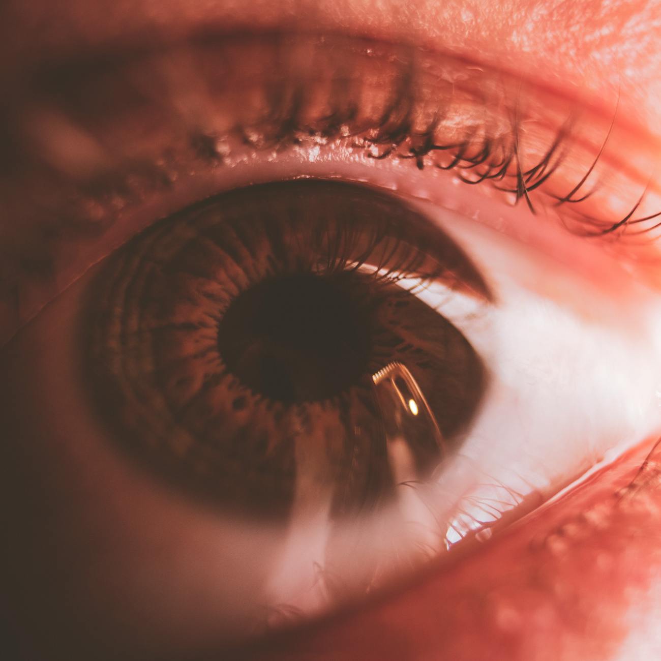 Deep Learning Algorithms for Eye Disease Diagnosis