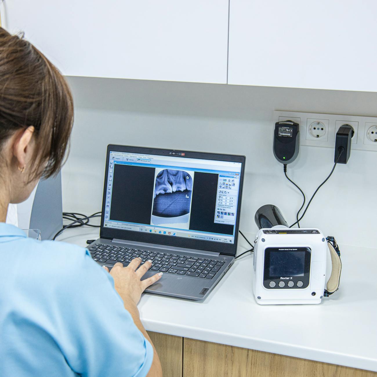 Clinical Integration of AI in Skin Lesion Analysis