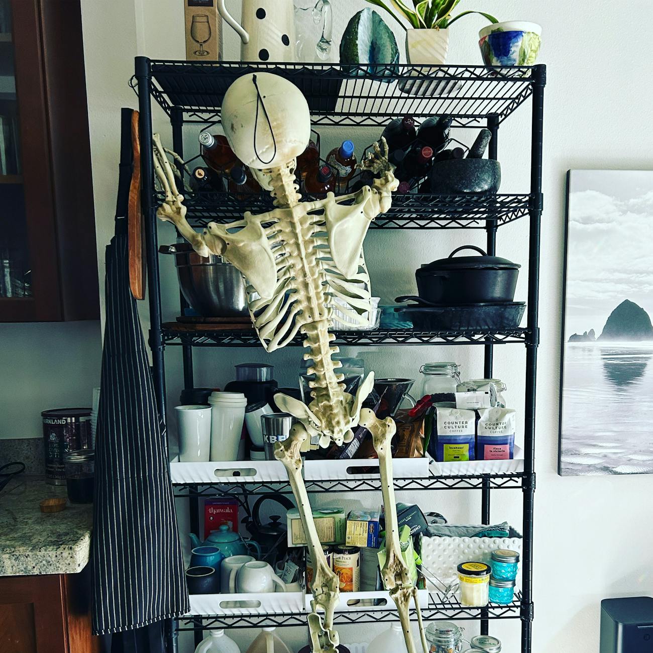 Biomechanics of the Skeleton