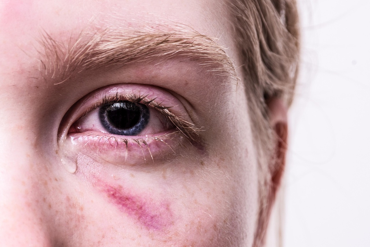 Neurorehabilitation Interventions for Traumatic Brain Injury