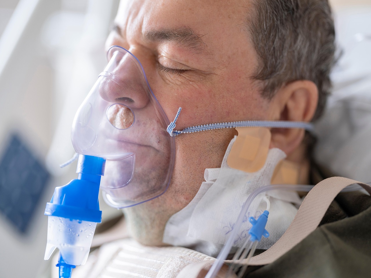 Carbon Monoxide Poisoning and Hyperbaric Oxygen Therapy