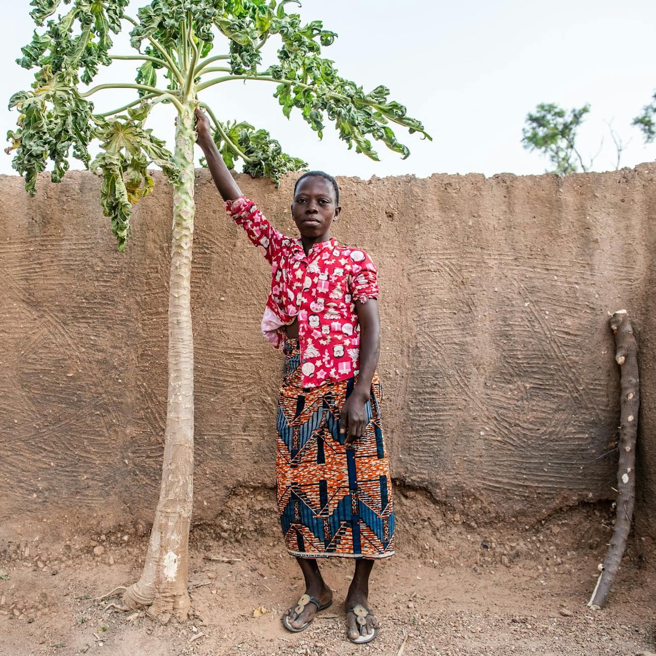 Advocacy and Resource Mobilization for NTDs